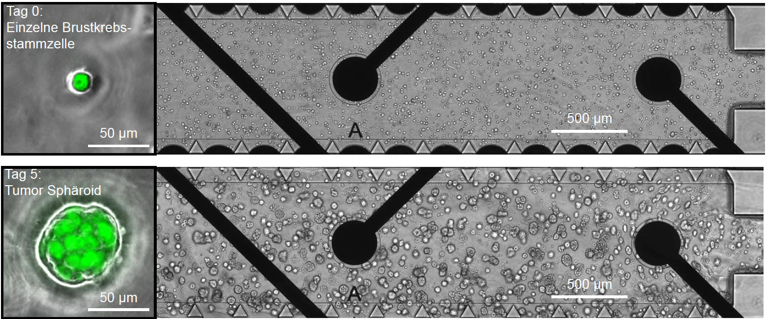 OrganonChipSysteme mit Mikrosensoren für Krebsforschung 2022