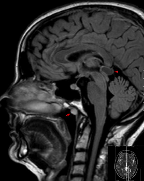 Magnetresonanztomographie Mrt In Der Depressionsforschung 12 Wiley Analytical Science