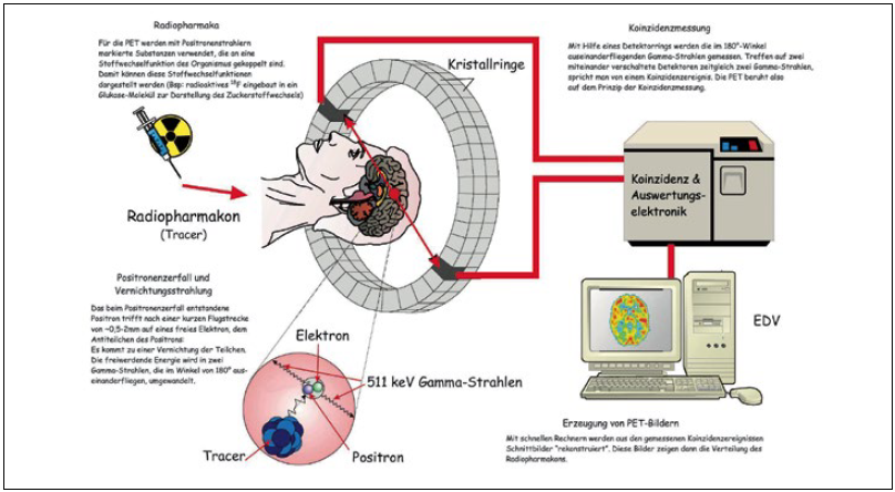 Positronen Emissions Tomographie 2014 Wiley Analytical Science