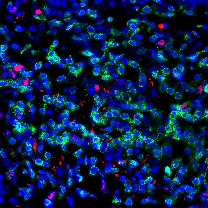 Zellmetabolismus als Schlüssel gegen allergische Hautkrankheiten ...