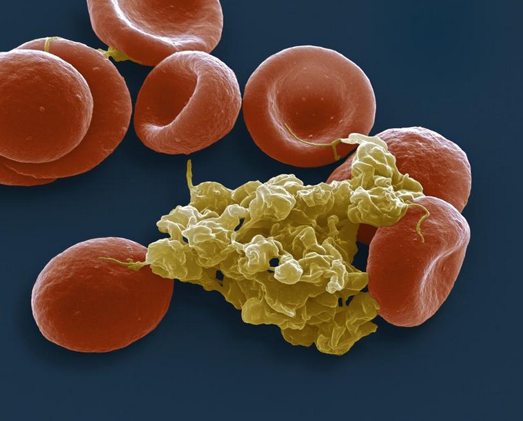 Comparison Of Platelet Concentrates Wiley Analytical Science