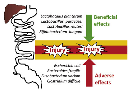 Probiotics And Their Influence On Health And Gut Microbiota - 2010 ...