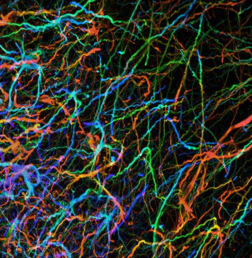 Lasers for Confocal Microscopy: All Colors of the Rainbow - 2011 ...