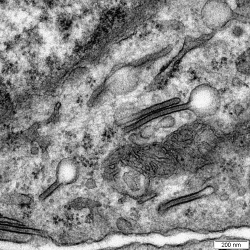 Diagnostic Transmission Electron Microscopy - 2012 - Wiley Analytical ...