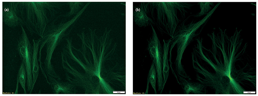 ccd camera fluorescence imaging