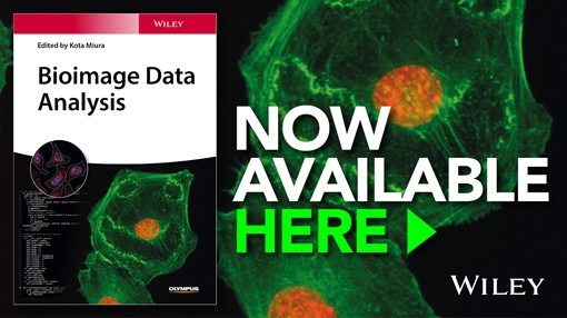 Download Your Copy Of Bioimage Data Analysis Now! - 2016 - Wiley ...