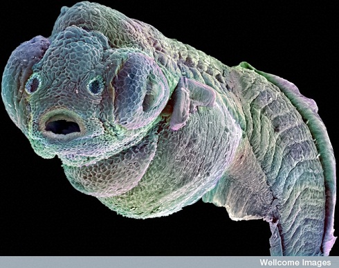 Wellcome Trust reveals microscopic wonders of the world - 2014 - Wiley ...