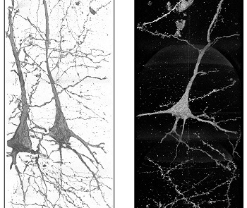 X-rays Shed New Light On Schizophrenia - 2021 - Wiley Analytical Science