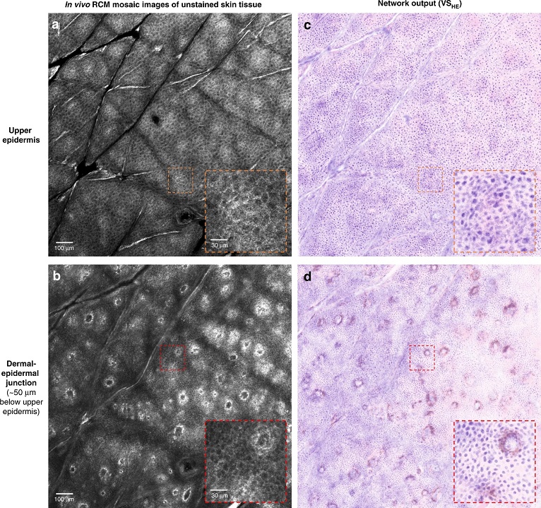 Virtual staining set to reduce need for skin biopsies - 2021 - Wiley  Analytical Science