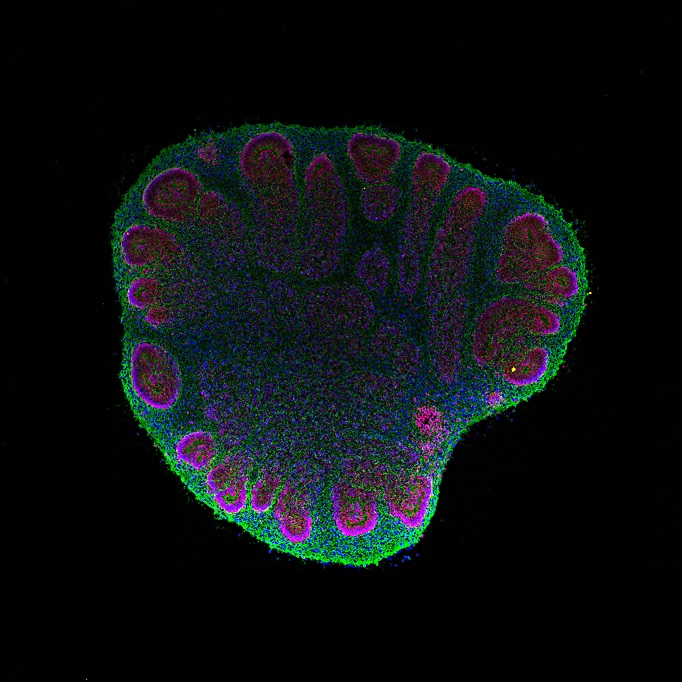 Space organoids to show how brains age - 2023 - Wiley Analytical Science