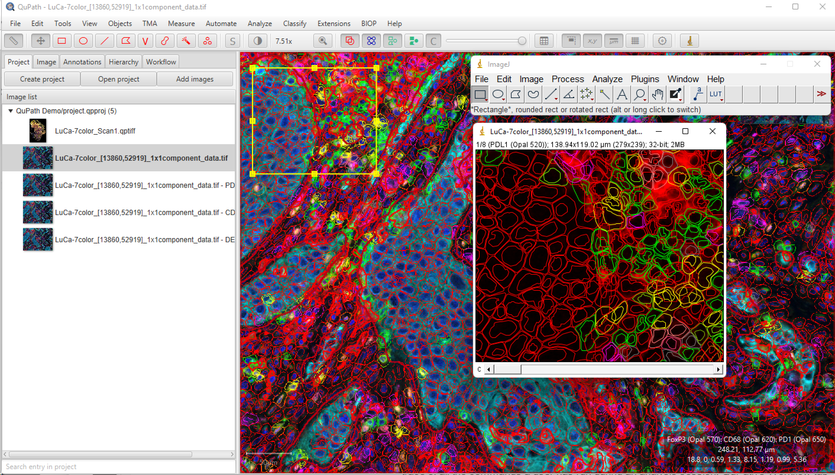 QuPath: Taking Full Control Through Workflows, Scripting, And ...