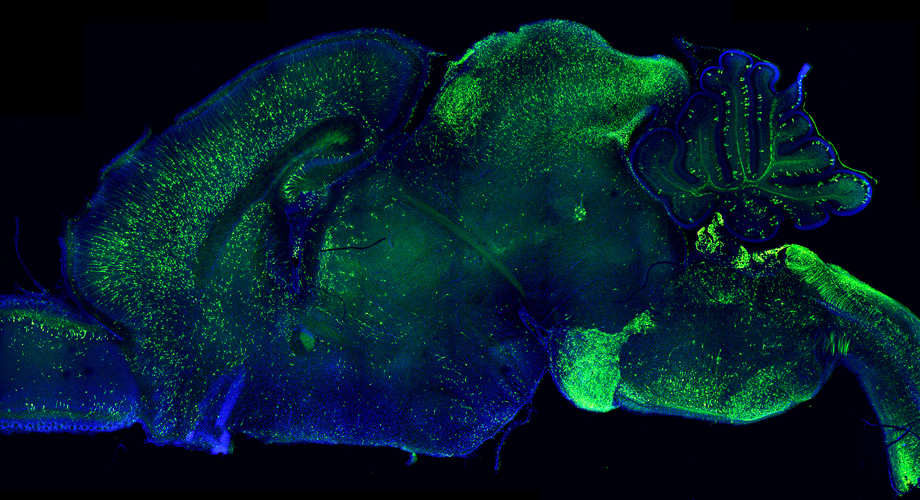 The view of the brain with the perturbation expression. (Image credit: Scripps Research)