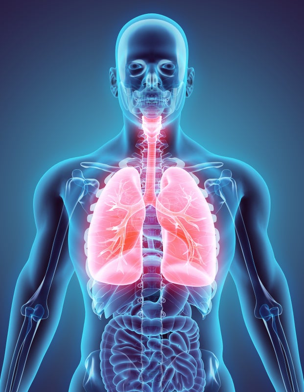 Interstitial lung disease: Diagnostic biomarkers - 2022 - Wiley ...