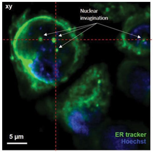 Adaptive 3D Cryogenic Correlative Light Imaging Of Native Biology Using ...