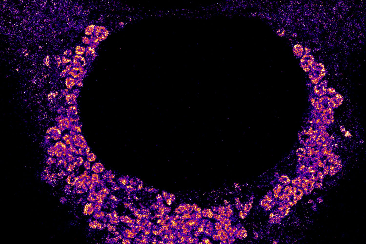 Viral RNA, labeled with a fluorescent dye, clusters around the nucleus of a cell infected with SARS-CoV-2, as captured through super-resolution microscopy. (Image Credit: Andronov et al., Nature Communications)