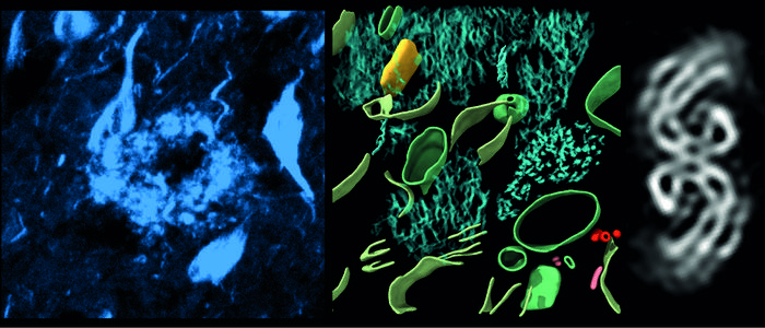 In-tissue 3d Protein Mapping Of Alzheimer's Brain - 2024 - Wiley 